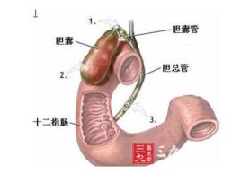 胃、十二指腸吻合術