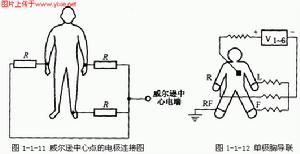 加壓導聯