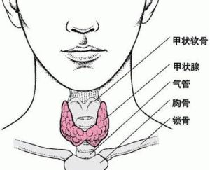 甲狀腺多發性結節