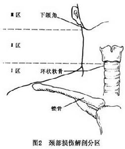 頸部開放性損傷