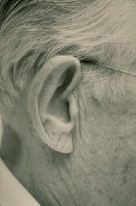 老年性耳聾