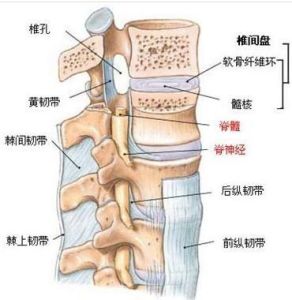 腰間盤突出症