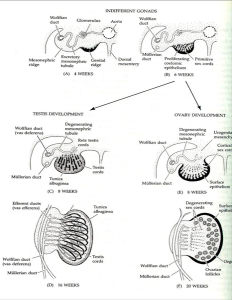 性腺發育不良