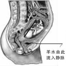 （圖）羊水由此流入靜脈