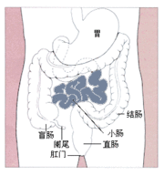 短腸綜合症