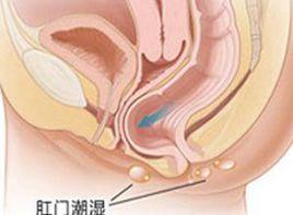 肛門夜間奇癢