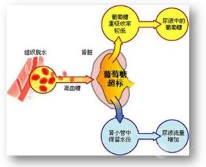 胰島素抵抗