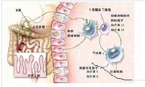 蛋白丟失性胃腸病