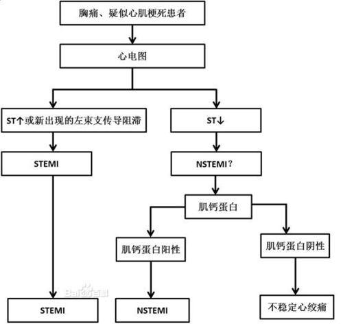 急性冠狀動脈綜合徵