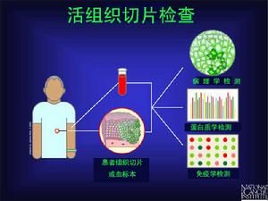 活組織切片