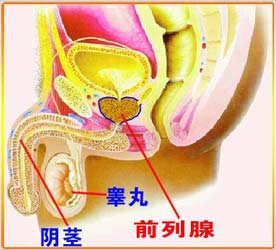 急性細菌性前列腺炎