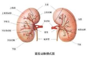 原發性高血壓