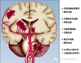 胎兒顱內出血