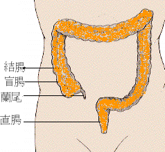 亞胺培南-西拉司丁鈉