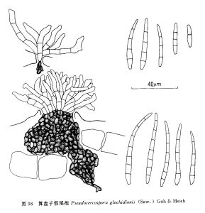 算盤子假尾孢