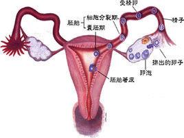 宮頸管積液