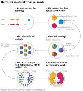 半同卵雙胞胎