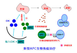 新型APC生物免疫治療