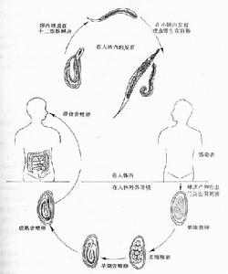 蠕形住腸線蟲