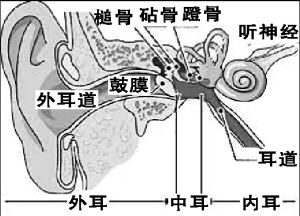 （圖）中耳癌