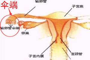 輸卵管傘