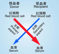 交叉配血