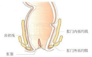 女性肛門損傷