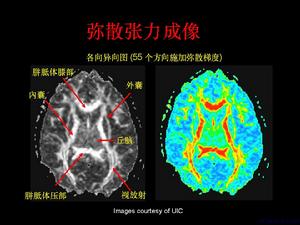 彌散過程可以用彌散敏感梯度磁場來測量