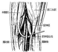 下肢深靜脈原發性瓣膜功能不全手術