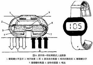 人工胰腺