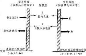 胸腔積液