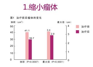 圖2縮小瘤體