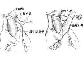 血缺氧