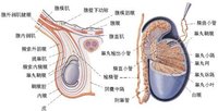 附睪囊腫切除術