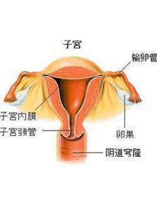 急性宮頸炎