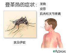 登革熱的症狀