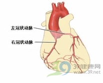 心肌梗塞並發心室間隔穿破