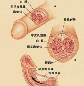 勃起異常