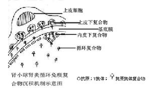 感染性急性小管間質性腎炎