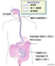 腸道內營養