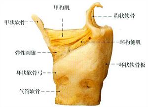 彈性圓錐