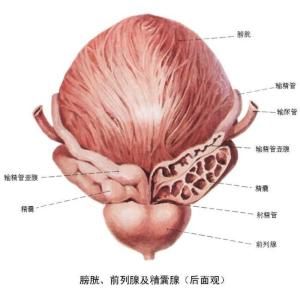 膀胱平滑肌瘤