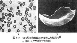 分子病