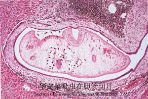 華支睪吸蟲