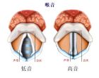 嗓音整容的原理