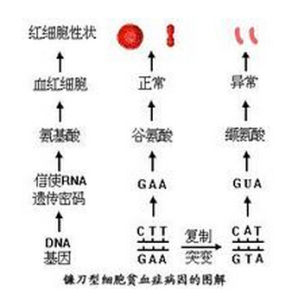 鐮刀型細胞貧血症