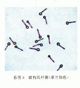 破傷風痙攣毒素