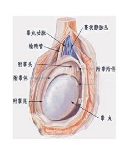 附睪鬱積症