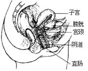 白帶異常示意圖