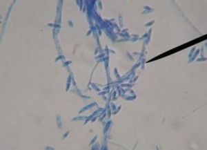 尖鐮孢菌